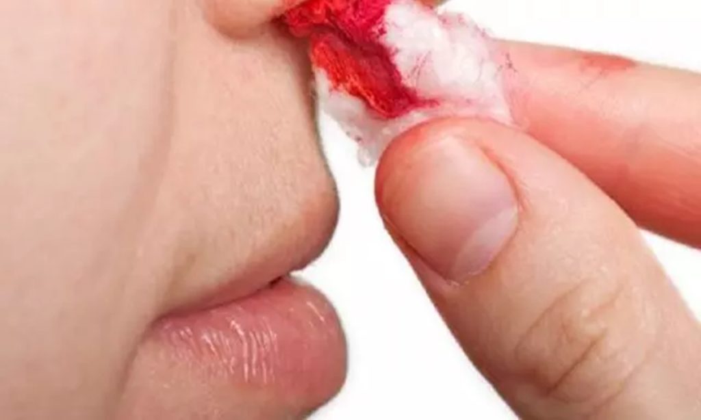 6 Dampak Buruk Mencabut Bulu Hidung bagi Kesehatan