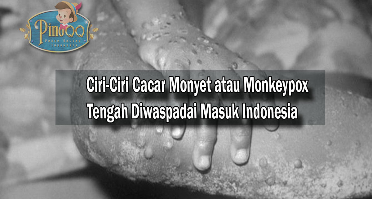 Ciri-Ciri Cacar Monyet/Monkeypox Tengah Diwaspadai Masuk Indonesia