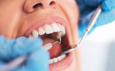 4 Penyebab Gigi Bungsu Harus Dicabut, Kenali Sebelum Terlambat