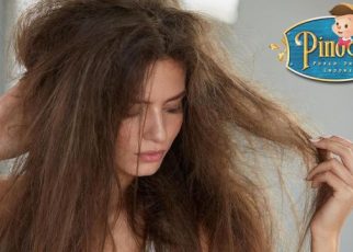 Kondisi Rambut yang Jadi Petunjuk Masalah Kesehatan dalam Tubuhmu