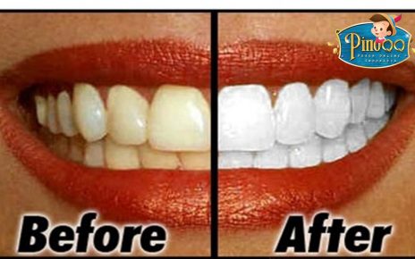 7 Cara Menghilangkan Noda Bekas Kopi di Gigi
